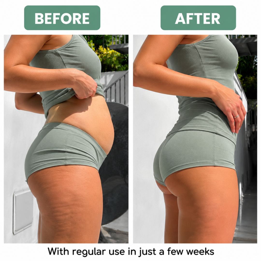 Fluxe™ Body Roller Massager Anti Cellulite